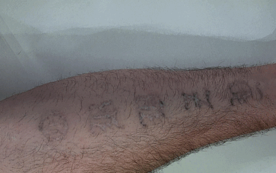 Webinar – Skin Deep Forensics