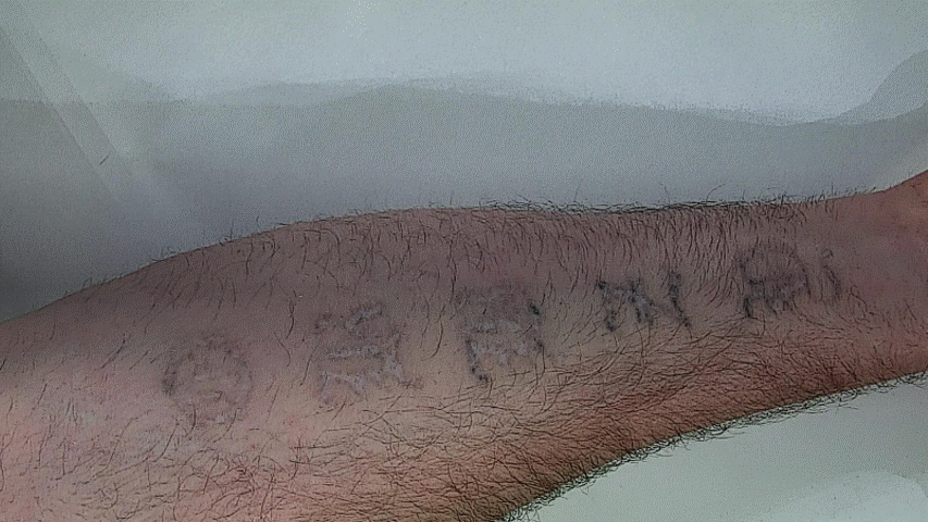 Webinar – Skin Deep Forensics