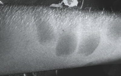 Webinar – The Power of Light: Forensic Light Sources for Sexual Assault and Physical Examinations